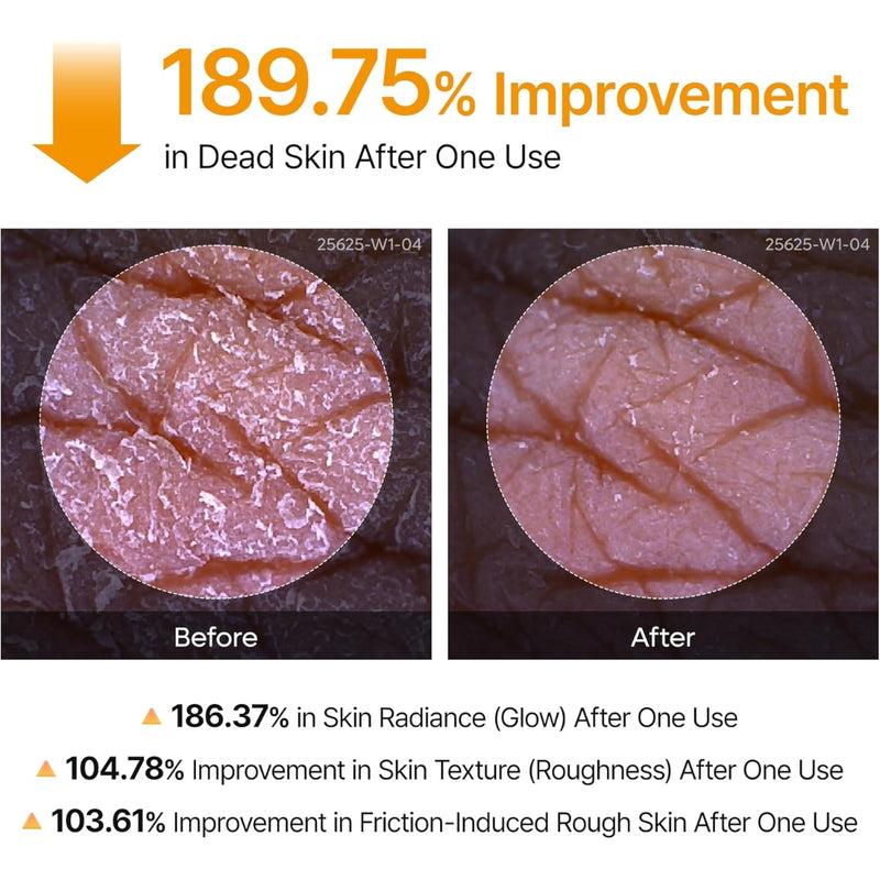 Dr. Melaxin Peel Shot Exfoliating Kojic Acid Turmeric Spray 200ml