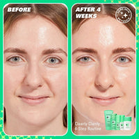 Revolution Skincare Clearly Me Clarifying Cleansing Gel 150ml