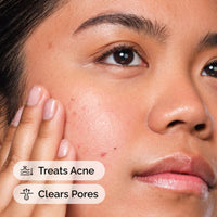 The Ordinary Salicylic Acid 2% Solution 30ml