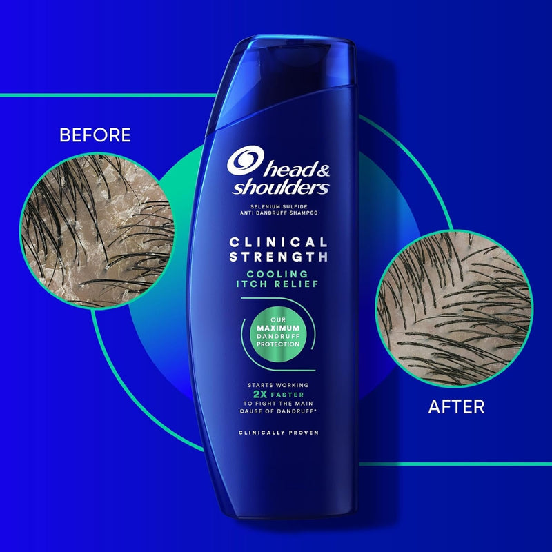 Head & Shoulders Clinical Strength Intensive Itch Relief Shampoo 400ml