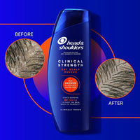 Head & Shoulders Clinical Strength Dry Scalp Rescue Shampoo 400ml