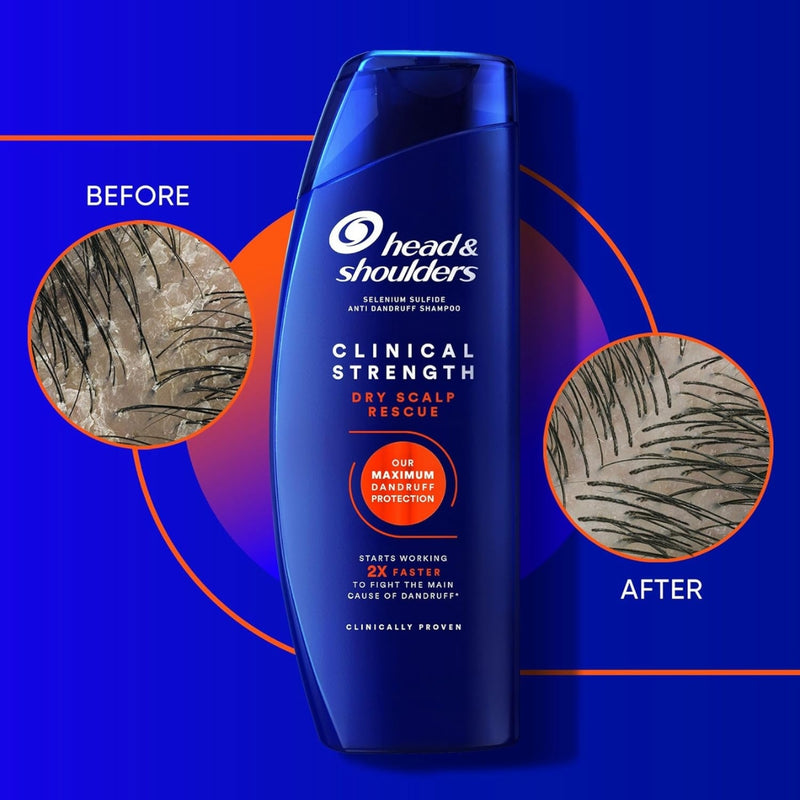 Head & Shoulders Clinical Strength Dry Scalp Rescue Shampoo 400ml