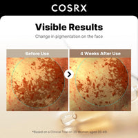 COSRX The Alpha Arbutin 2 Discoloration Care Serum 50ml