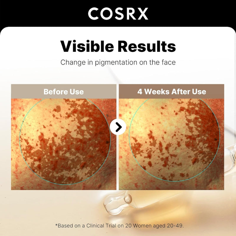 COSRX The Alpha Arbutin 2 Discoloration Care Serum 50ml