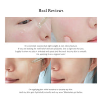 Dr. Althea Skin Relief Essence 30ml