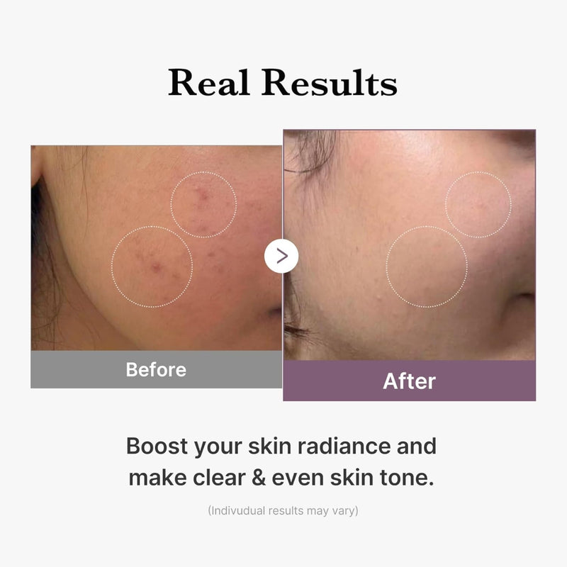Medicube Age-R Glutathione Glow Toner 140ml