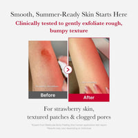 Medicube Red Acne Body Peeling Shot 110g