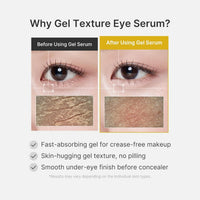 Medicube Kojic Acid Turmeric Vita Eye Gel Serum 30ml