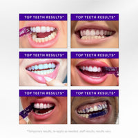 Hismile V34 Teeth Whitening 14 Strips