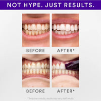 Hismile V34 Teeth Whitening 14 Strips