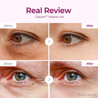 Dr Melaxin Cemenrete Calcium Volume Eye Patch 60 Pieces