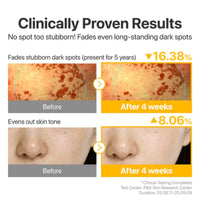 Numbuzin 5 Glutathione TXA Advanced Dark Spot Ampoule Concentrate 30ml