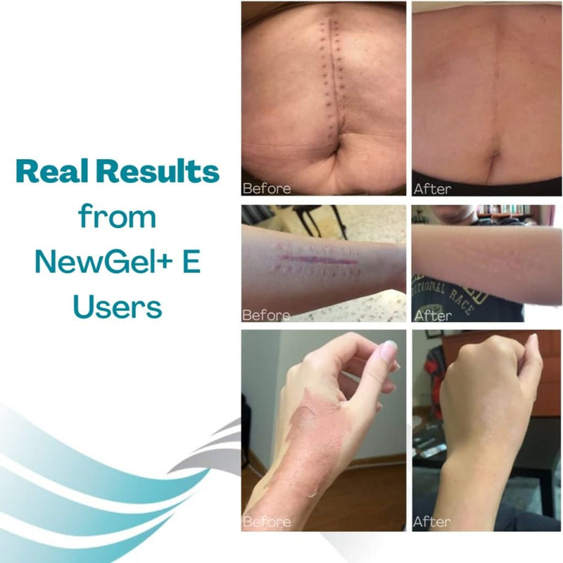 New Gel+ E Advanced Silicone Gel 15g