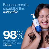 Be Bodywise 1% Salicylic Acid Body Wash 700ml