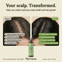 Nyrvana Scalp & Hair Mist Rosemary 100ml